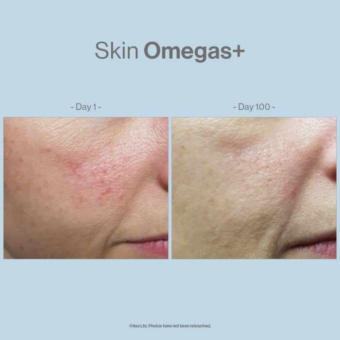 Skin Omegas+ - Image 3