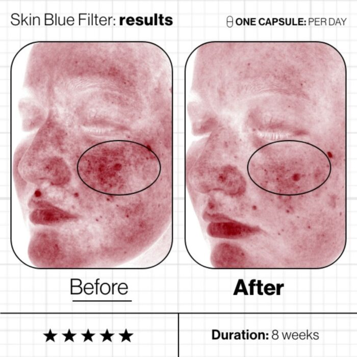 Skin Blue Filter - Image 3