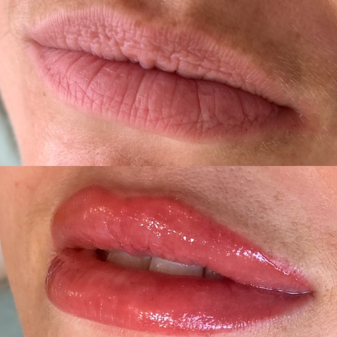 Semi Permanent Lips Photo