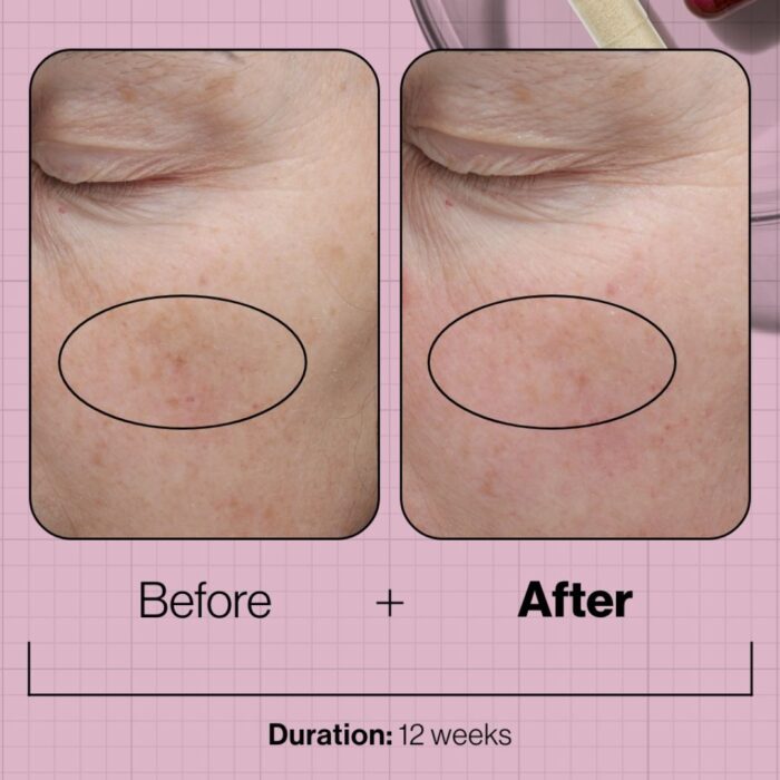 Skin Even IQ - Image 2