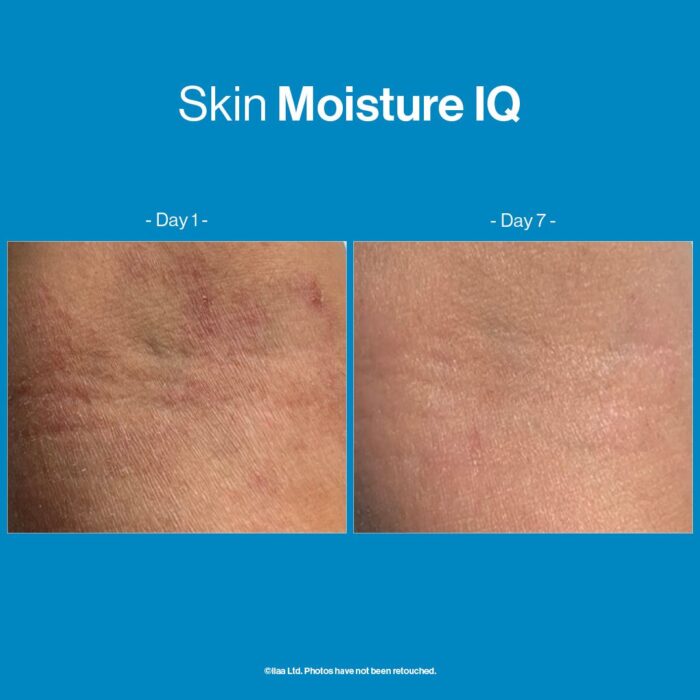 Skin Moisture IQ - Image 2