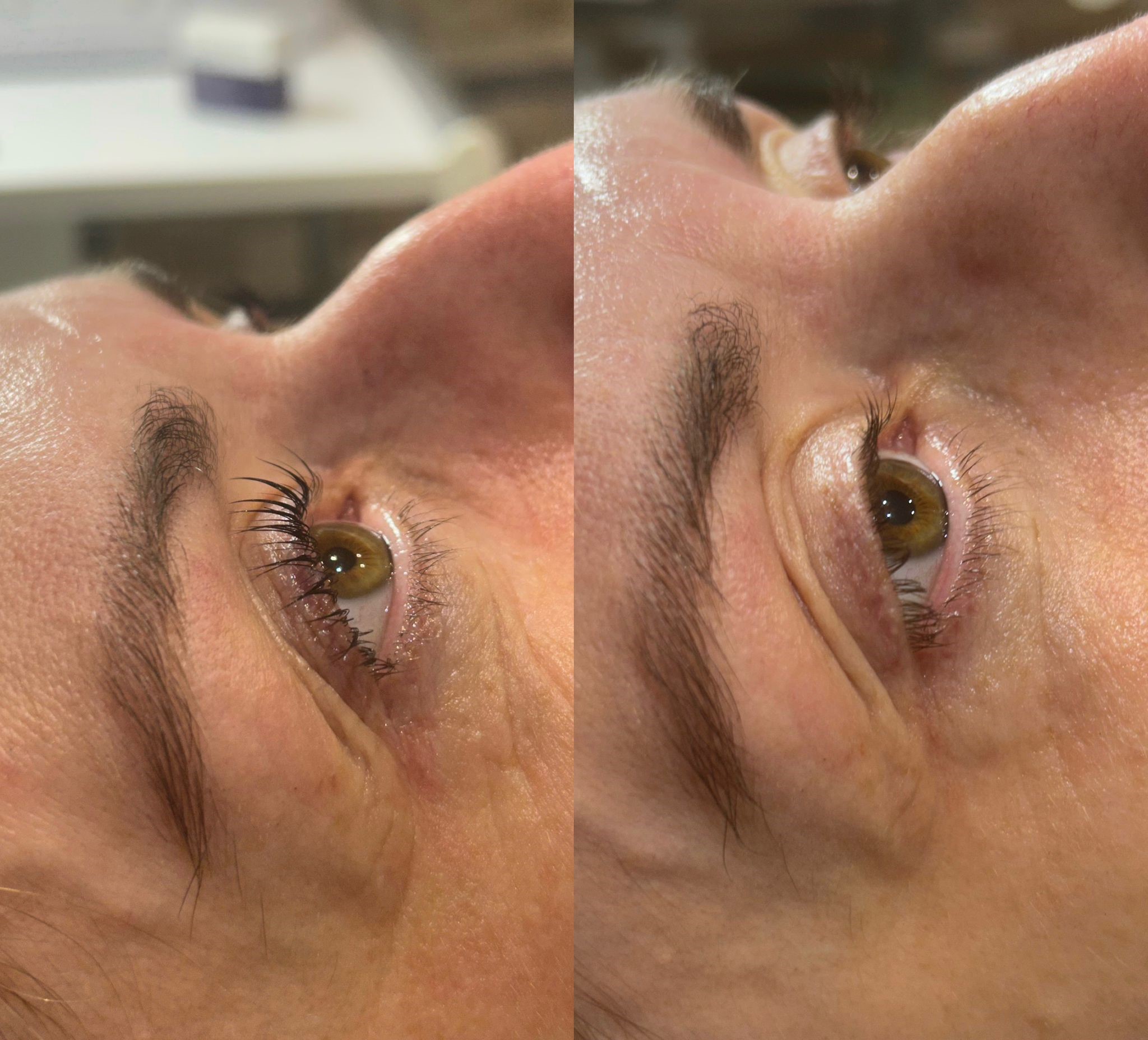 LVL before and after by Chloe August 2023