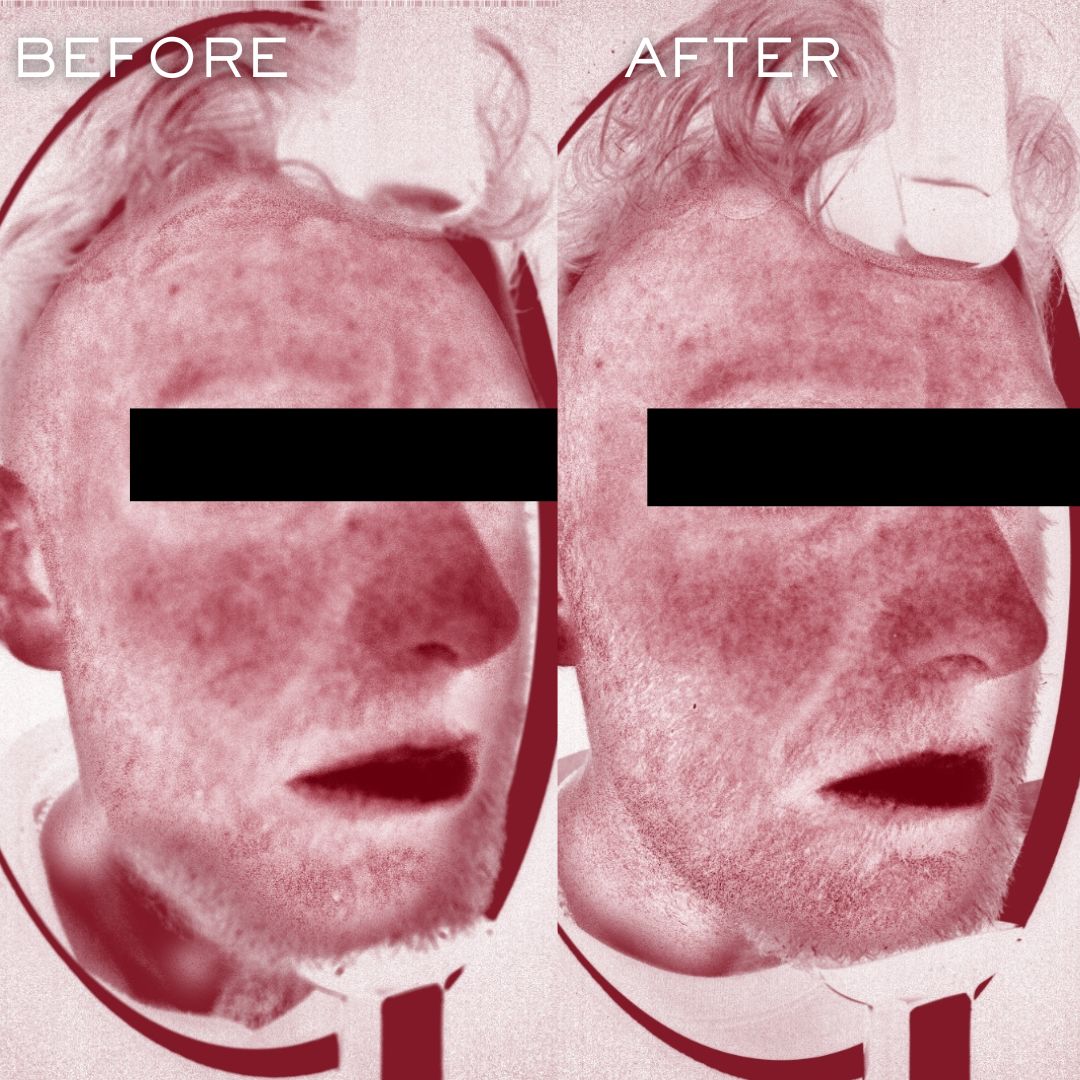 Before and After 2023