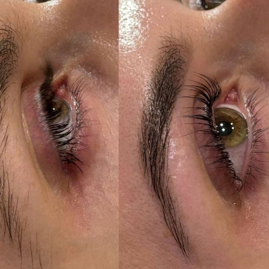 Before and After 2023-3