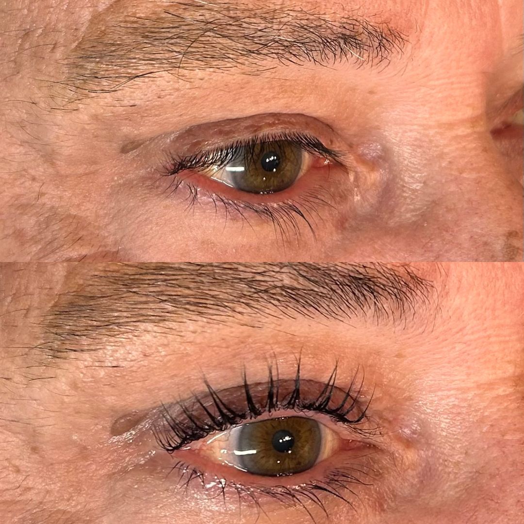 Millie's Before & After LVL's 2025